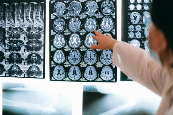 Studi terbaru menunjukkan konsentrasi mikroplastik di otak jauh lebih besar dibanding organ tubuh lainnya, bahkan meningkat drastis di beberapa tahun terakhir