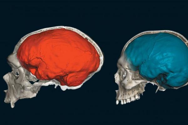 Kini, penelitian dari Clemson University dan Loyola University menunjukkan bahwa potongan DNA itu mungkin memengaruhi cara otak kita bekerja&mdash;termasuk kecenderungan terhadap spektrum autisme.