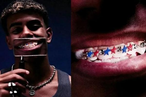 Kisah unik kawat gigi penyerang Barcelona, Lamine Yamal yang jadi barang berharga